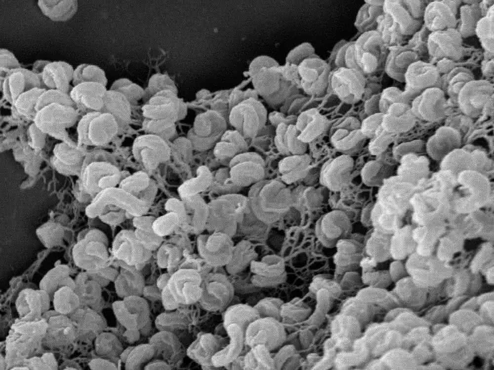 Elektronenmikroskopische Aufnahme eines Zell-Aggregats von Comammox-Bakterien der Art Nitrospira inopinata.