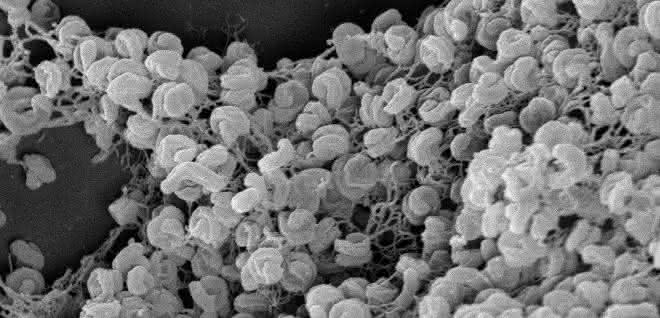 Elektronenmikroskopische Aufnahme eines Zell-Aggregats von Comammox-Bakterien der Art Nitrospira inopinata. Elektronenmikroskopische Aufnahme eines Zell-Aggregats von Comammox-Bakterien der Art Nitrospira inopinata.