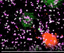 Angriff der Killerzellen: CAR-NK-Zellen (violett), die gegen ein krebsspezifisches Oberflächenprotein gerichtet sind, zerstören nur Darmkrebs-Organoide (grün) und verschonen Organoide aus gesunden Darmzellen (rot). Mikroskopische Aufnahme zum Angriff der Killerzellen