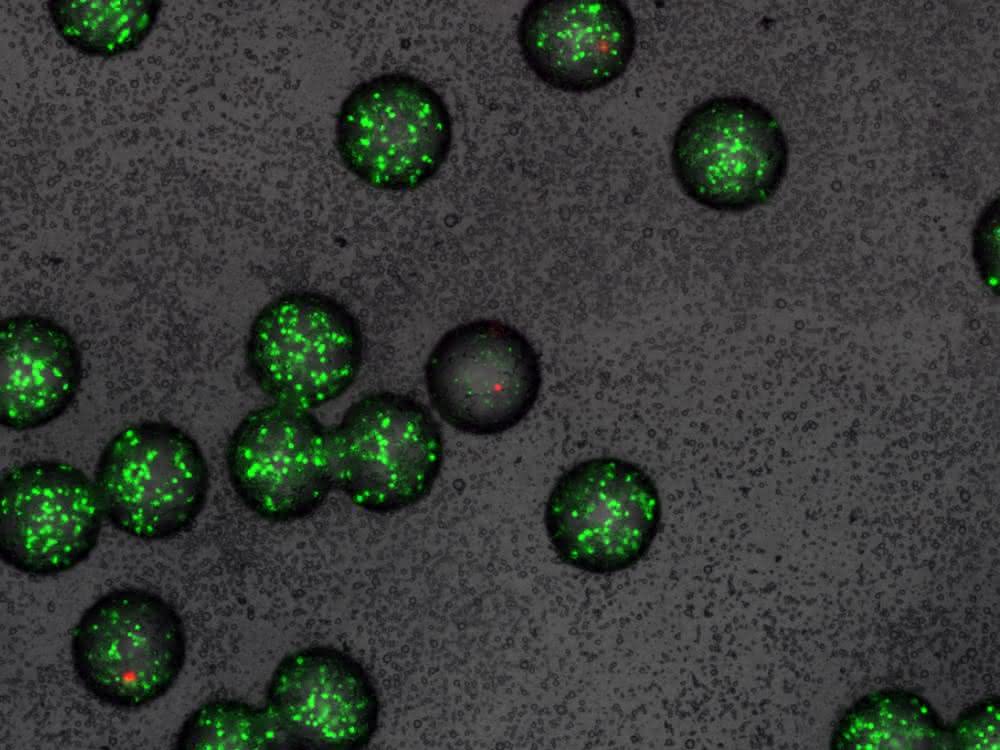 Mikro-Gel-Kügelchen mit grün fluoreszierenden Sensor-Bakterien. In einem der Kügelchen (Mitte) wurden die Sensor-Bakterien von einem Wirkstoff abgetötet (mikroskopische Aufnahme).