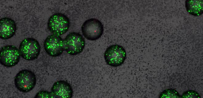 Mikro-Gel-Kügelchen mit grün fluoreszierenden Sensor-Bakterien. In einem der Kügelchen (Mitte) wurden die Sensor-Bakterien von einem Wirkstoff abgetötet (mikroskopische Aufnahme).