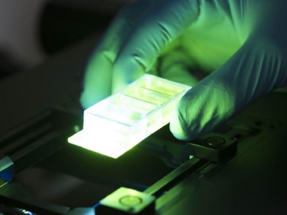 DNA-stabilisierte Metall-Quanten-Cluster sollen als hochempfindliche Biosensoren eingesetzt werden, um mit ihren Fluoreszenzeigenschaften Krankheiten zu detektieren.