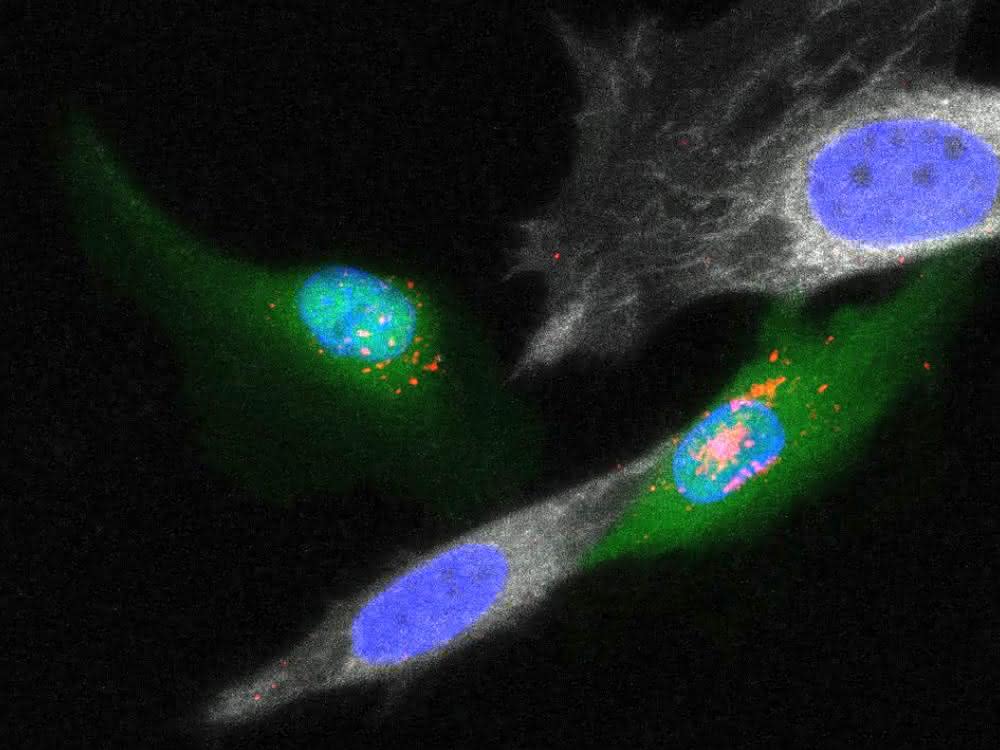 Erkennung von Zielzellen durch virusmimetische Nanopartikel in Zellgemischen.