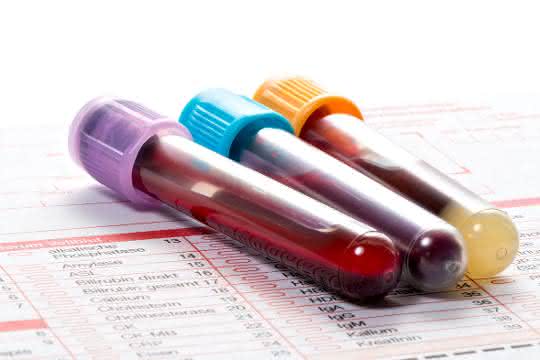 Tubes with blood samples