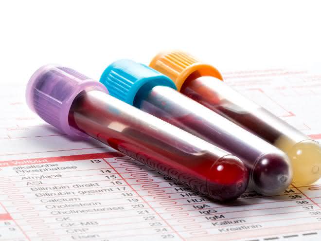 Tubes with blood samples