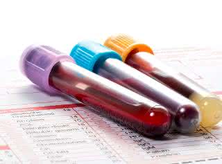 Insights into the genetic regulation of lipid metabolism and its link to human diseases might help guide future biomarker. Tubes with blood samples