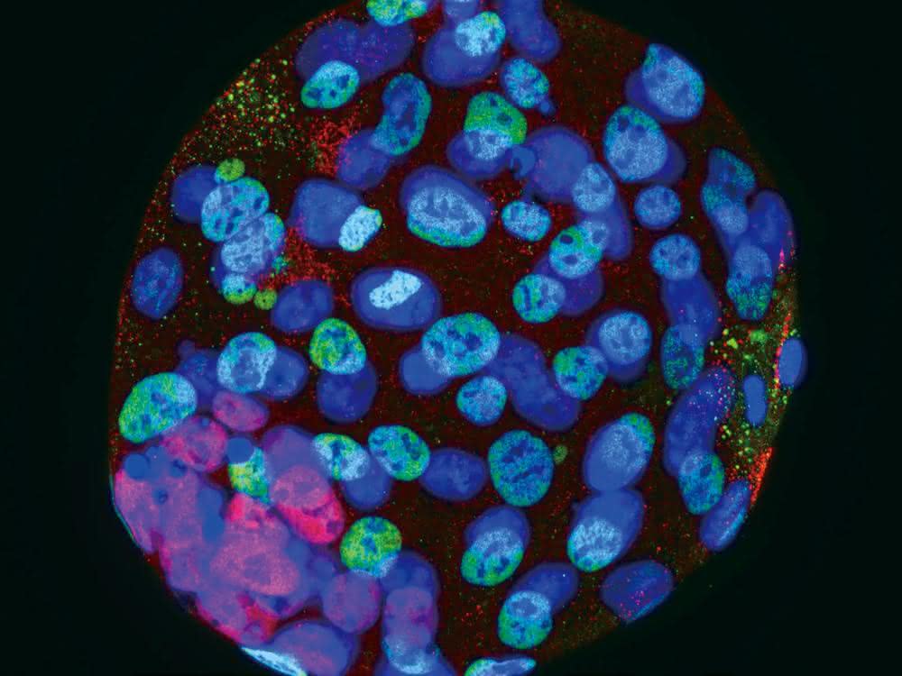 Imaging: Kompaktes Fluoreszenzmikroskop mit integrierter Dunkelkammer