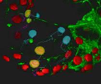 Image from image analysis solution "Vision4D" with integrated Machine Learning for easy and reliable image analysis Image from image analysis solution "Vision4D" with integrated Machine Learning for easy and reliable image analysis
