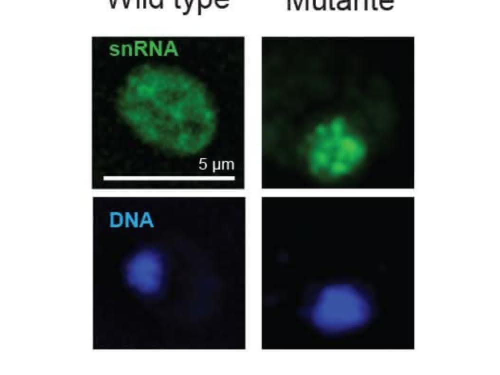 Nachweis der zytoplasmatischen snRNA in normalen (Wild type) Zellen im Cytoplasma und das „Festhalten“ dieser snRNA in genetisch veränderten Zellen.