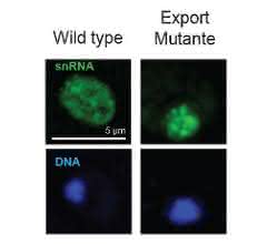Nachweis der zytoplasmatischen snRNA in normalen (Wild type) Zellen im Cytoplasma und das „Festhalten“ dieser snRNA in genetisch veränderten Zellen.