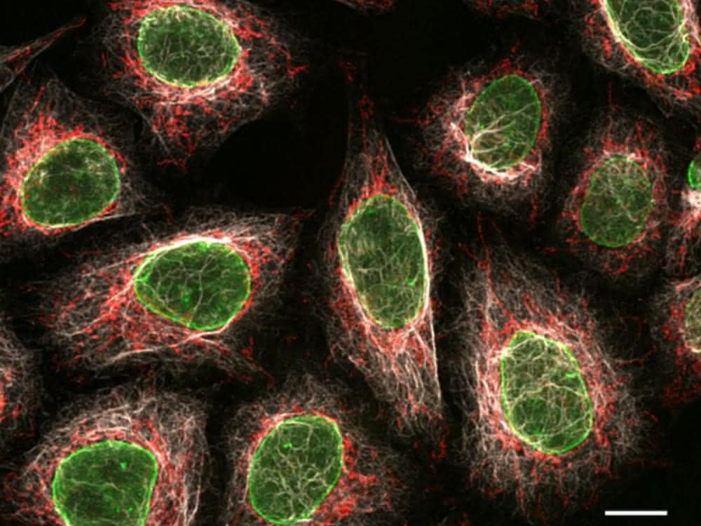 Multiplex Immunofärbung verschiedener Proteine in HeLa Zellen Multiplex Immunofärbung verschiedener Proteine in HeLa Zellen
