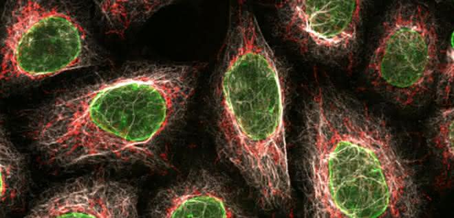 Multiplex Immunofärbung verschiedener Proteine in HeLa Zellen