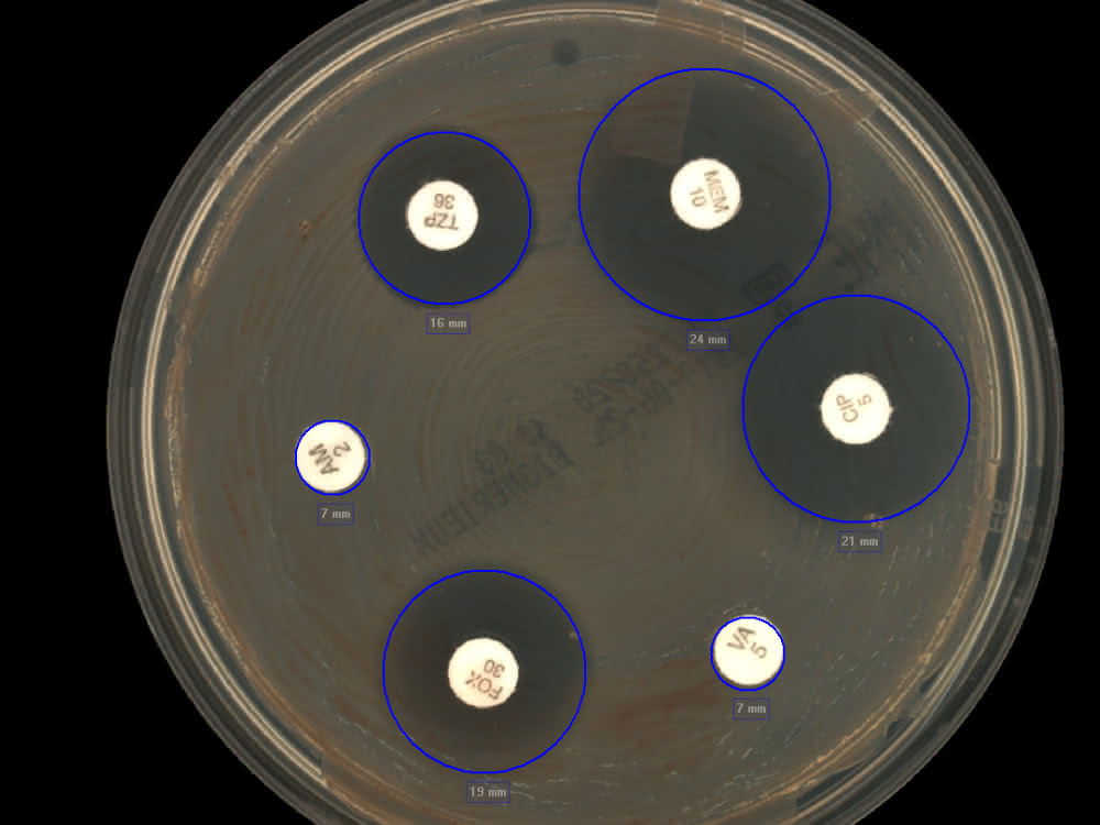 Bild 3: RAST – E. coli aus positiver Blutkulturflasche, Müller-Hinton-Agar, sechs Stunden Inkubation bei 35 °C mit ausgemessenen Hemmhöfen. Bild 3: RAST – E. coli aus positiver Blutkulturflasche, Müller-Hinton-Agar, sechs Stunden Inkubation bei 35 °C mit ausgemessenen Hemmhöfen.