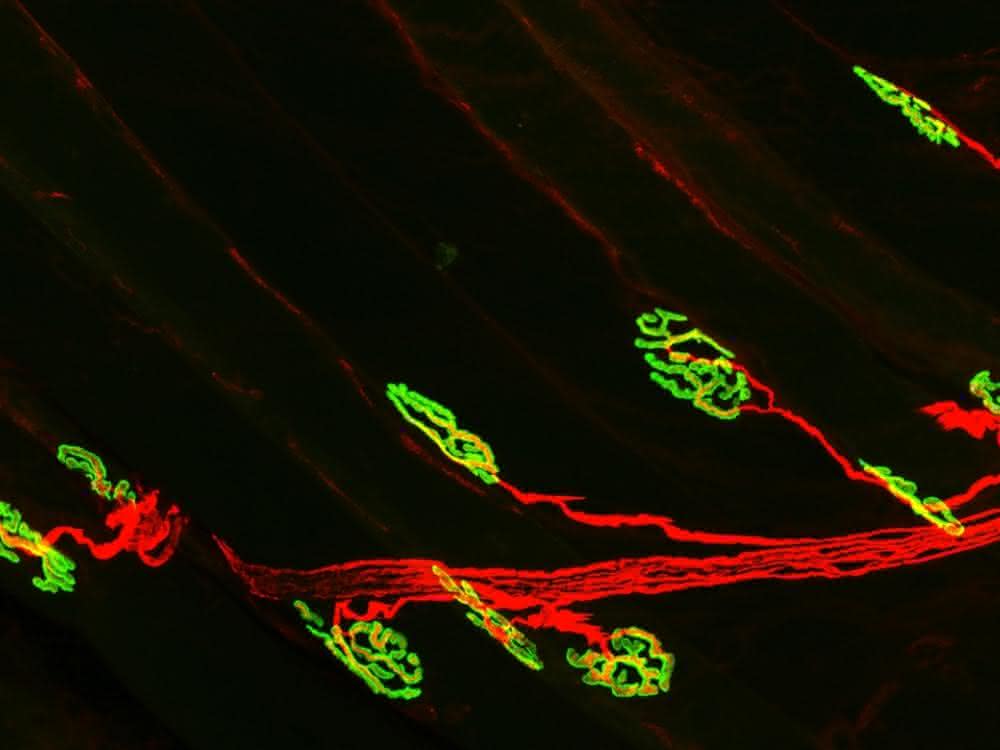 Die neuromuskuläre Synapse: Das Motorneuron (rot) aktiviert den Muskel über die Acetylcholinrezeptoren (grün).