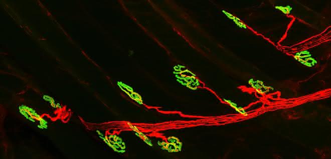 Die neuromuskuläre Synapse: Das Motorneuron (rot) aktiviert den Muskel über die Acetylcholinrezeptoren (grün).