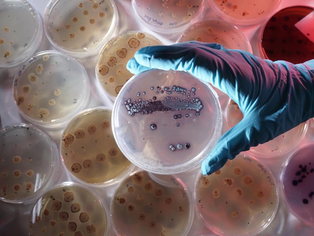 Petrischale mit dem Bakterium Streptomyces lividans