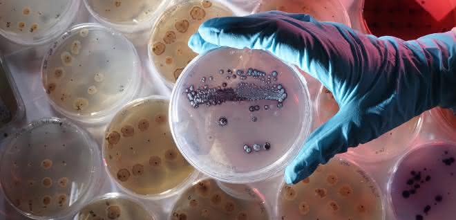 Petrischale mit dem Bakterium Streptomyces lividans