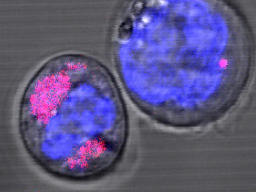 CD34+-Stammzellen mit Kohlenstoff-Nanopartikeln (magenta); in Blau sind die Zellkerne zu sehen. Die Forscher stellten fest, dass die Nanopartikel in den Lysosomen der Zelle eingeschlossen sind. Bild von Zellen