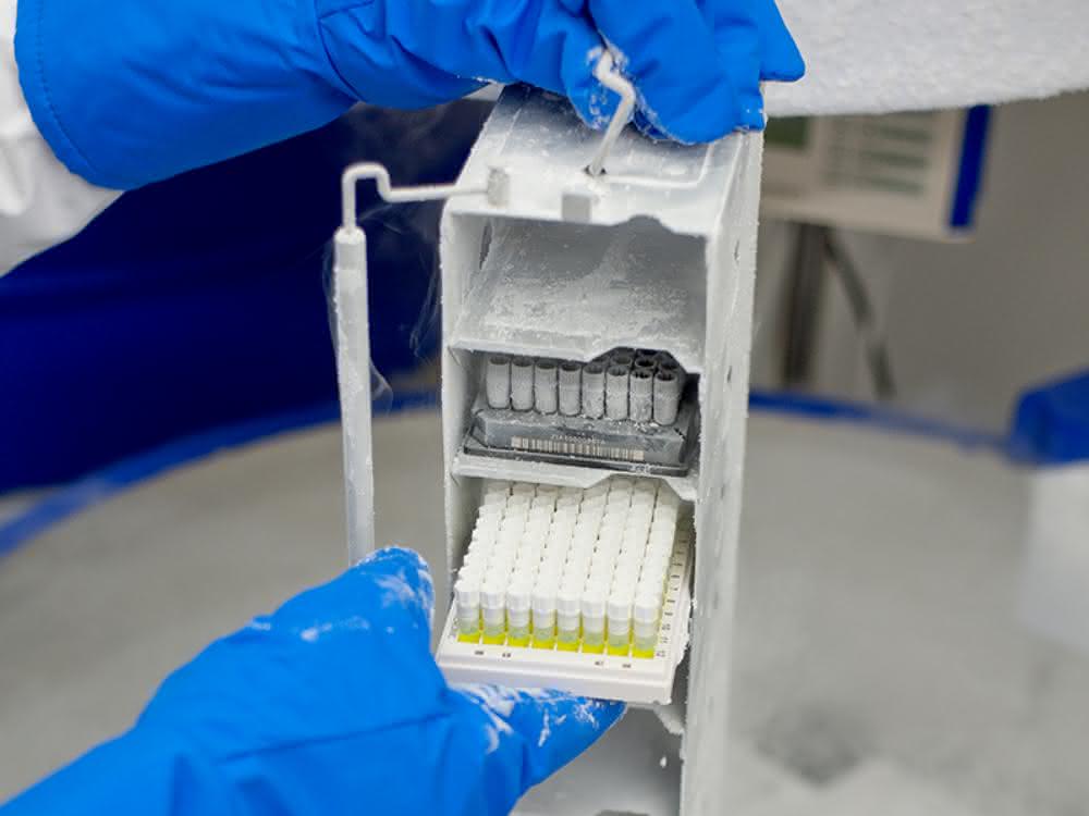 Bioproben wandern in den Stickstofftank