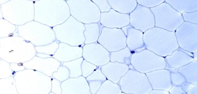 Diese Fettzellen wollen Prof. Körner und Prof. Blüher mit internationalen Kollegen für den "Human Cell Atlas" kartieren