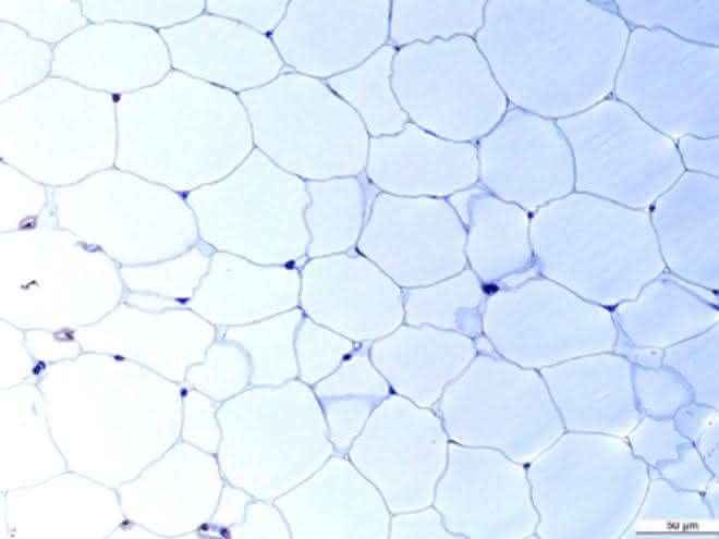 Diese Fettzellen wollen Prof. Körner und Prof. Blüher mit internationalen Kollegen für den "Human Cell Atlas" kartieren