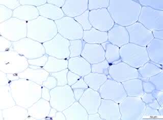 Diese Fettzellen wollen Prof. Körner und Prof. Blüher mit internationalen Kollegen für den "Human Cell Atlas" kartieren Diese Fettzellen wollen Prof. Körner und Prof. Blüher mit internationalen Kollegen für den "Human Cell Atlas" kartieren