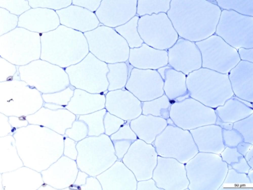 Diese Fettzellen wollen Prof. Körner und Prof. Blüher mit internationalen Kollegen für den "Human Cell Atlas" kartieren