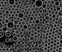 Bakterien in Tröpfchenform, erzeugt durch die Lab-on-a-Chip-Technologie. Mikroskopische Aufnahme von Bakterien in Tröpfchenform, erzeugt durch die Lab-on-a-Chip-Technologie.