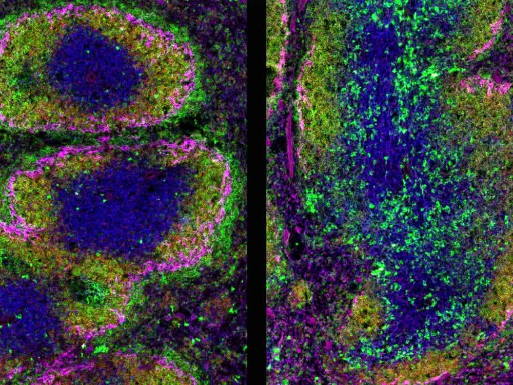 Querschnitt durch die Milz einer 10 Wochen alten Maus und Immunfluoreszenzfärbung. Querschnitt durch die Milz einer 10 Wochen alten Maus und Immunfluoreszenzfärbung.