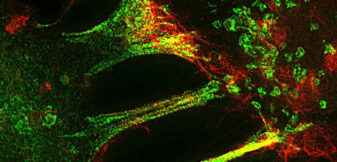 Fluoreszenzmikroskopische Aufnahme während der Trogozytose.