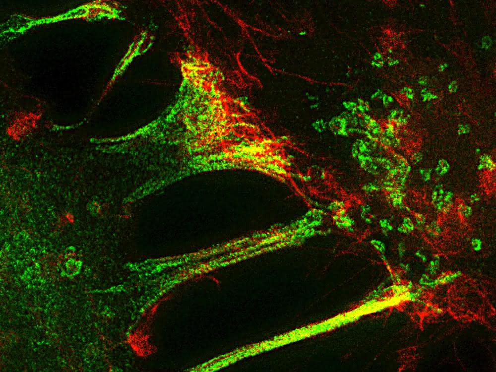 Fluoreszenzmikroskopische Aufnahme während der Trogozytose.