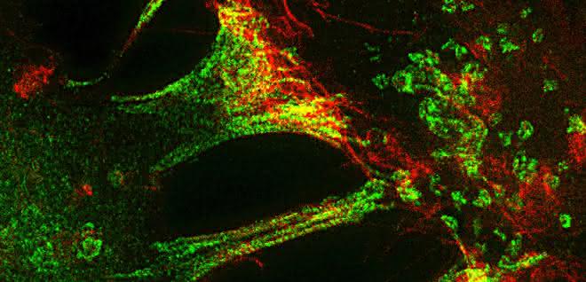 Fluoreszenzmikroskopische Aufnahme während der Trogozytose.
