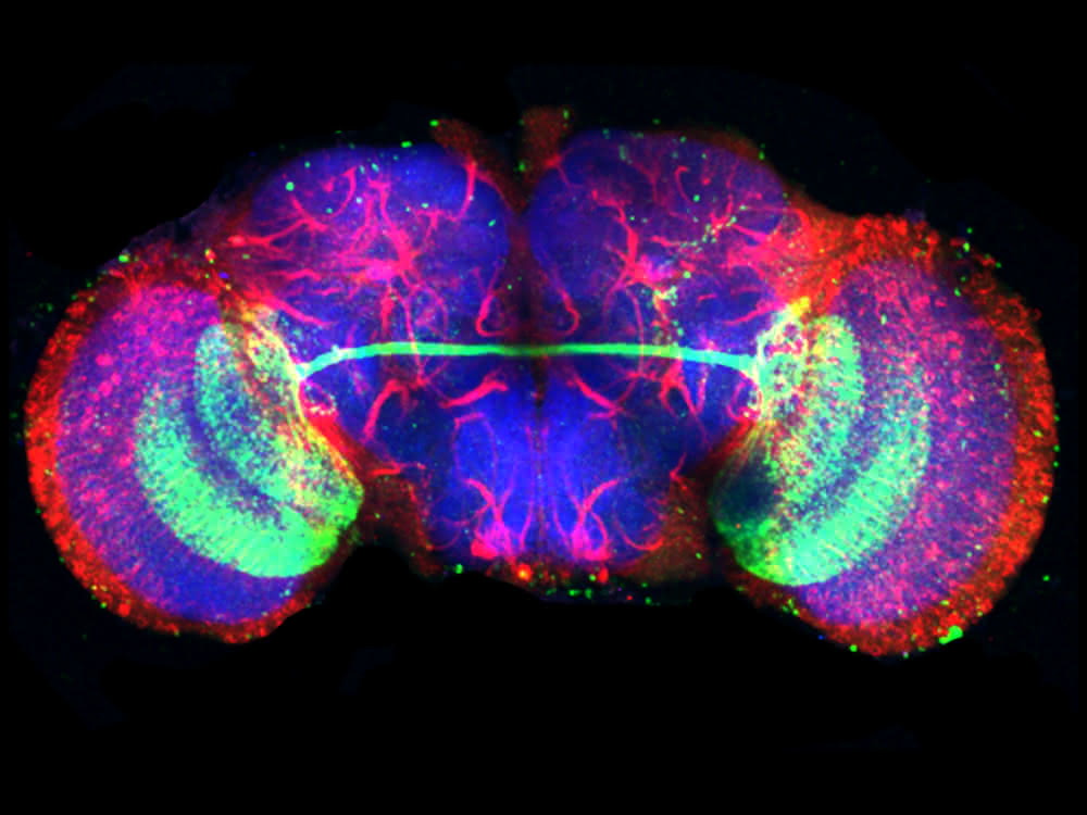 Mikroskopische Aufnahme des Drosophila-Gehirns