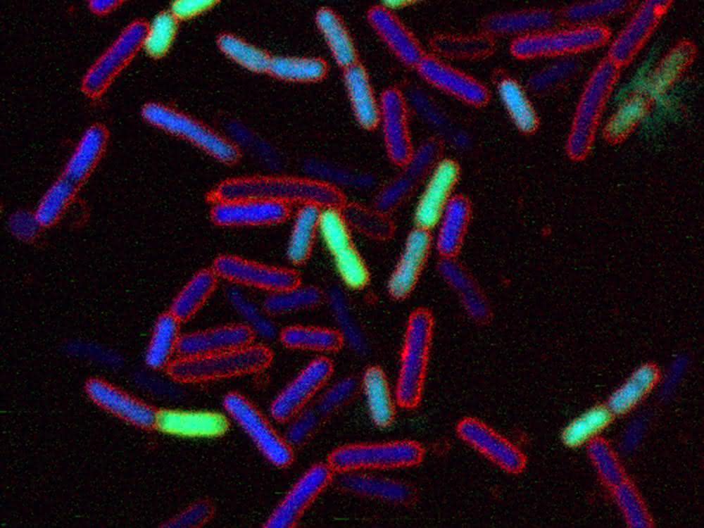 Mikroskopische Aufnahme von Escherichia coli-Bakterien, die mit dem neuartigen Antibiotikum behandelt wurden.