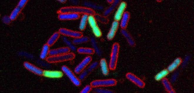 Mikroskopische Aufnahme von Escherichia coli-Bakterien, die mit dem neuartigen Antibiotikum behandelt wurden.