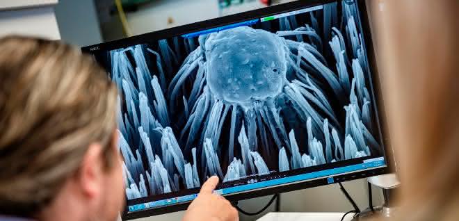 Mittels Rasterelektronenmikroskopie wird die Interaktion zwischen Zellen und Bakterien mit den nanostrukturierten Oberflächen untersucht.