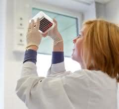 Im DKMS Life-Science-Lab prüft eine Mitarbeiterin ein vorbreitetes Blutprobenpanel auf den korrekten Füllstand.