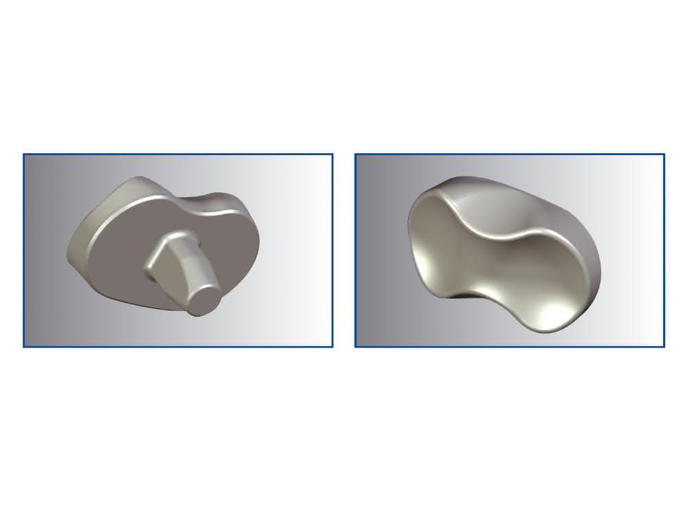 Knee implant