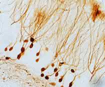 Nervenzellen im Hippokampus des Gehirns (Tiermodell). Für den neuen gentherapeutischen Ansatz wird hier ein zusätzliches Gen eingeschleust, sodass die Zellen bei Bedarf Dynorphin ausschütten. Nervenzellen im Hippokampus des Gehirns (Tiermodell).