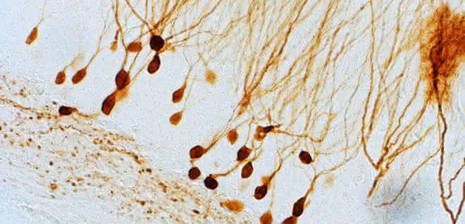 Nervenzellen im Hippokampus des Gehirns (Tiermodell). Für den neuen gentherapeutischen Ansatz wird hier ein zusätzliches Gen eingeschleust, sodass die Zellen bei Bedarf Dynorphin ausschütten. Nervenzellen im Hippokampus des Gehirns (Tiermodell).