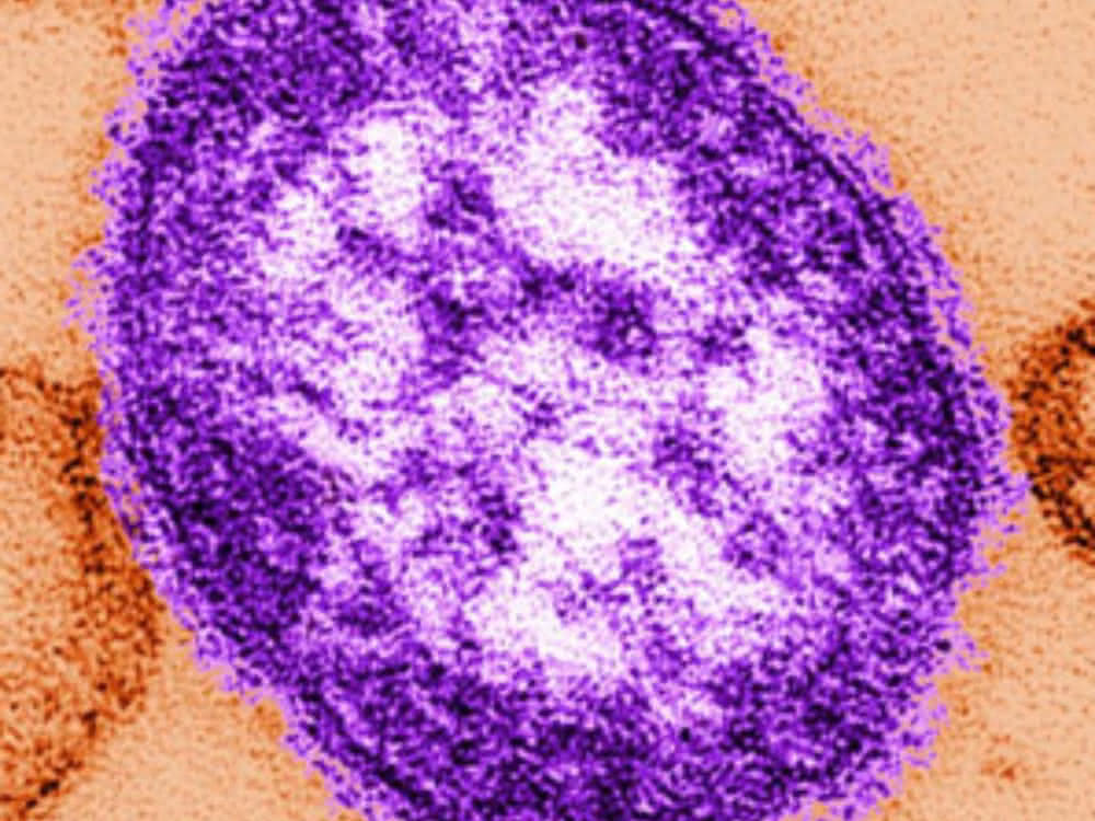 Masernvirus