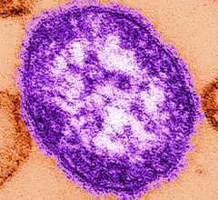Masernvirus