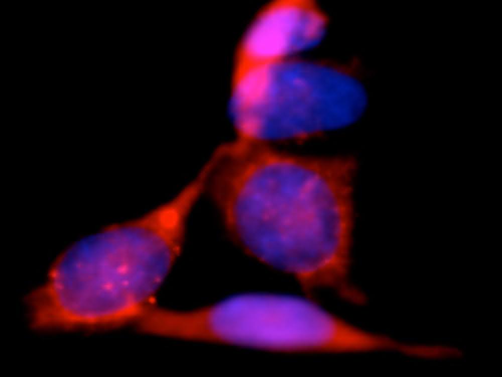 Zellen, die mit dem neu entwickelten Fluoreszenz-gelabelten Conotoxin inkubiert wurden. Leuchtende Zellen (mit roten, violetten und rosafarbenen Bereichen) auf schwarzem HIntergrund.