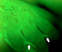 Durch Apoptose bauen sich unter anderem die Zellen ab (grün), die zwischen den Zehen der Maus während der Embryonalentwicklung die Interdigitalfalten („Schwimmhäute“) bilden. Mikroskopische Aufnahme von Zellen, die zwischen den Zehen der Maus während der Embryonalentwicklung die Interdigitalfalten („Schwimmhäute“) bilden