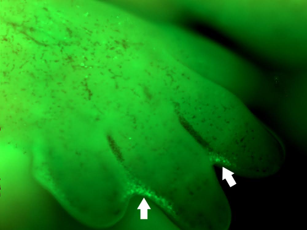 Mikroskopische Aufnahme von Zellen, die zwischen den Zehen der Maus während der Embryonalentwicklung die Interdigitalfalten („Schwimmhäute“) bilden