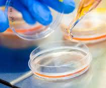 For new treatment approaches: Promocell now offers in vitro disease models