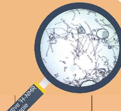 Mikroplastik-Analyse: 1,2,3… Gibt es eine Alternative zum Auszählen von Partikeln? Lupe und NMR-Spektrum