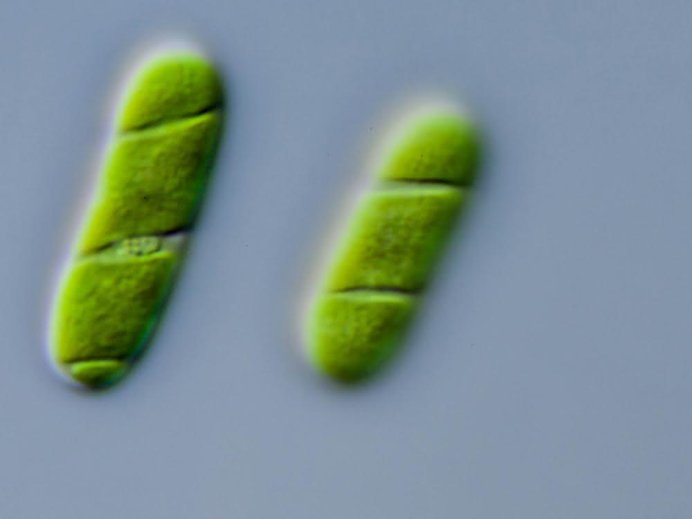 Evolution der Landpflanzen: Gentransfer: Bakterien halfen Pflanzen das Land zu erobern Mikroskopische Aufnahme von Algen