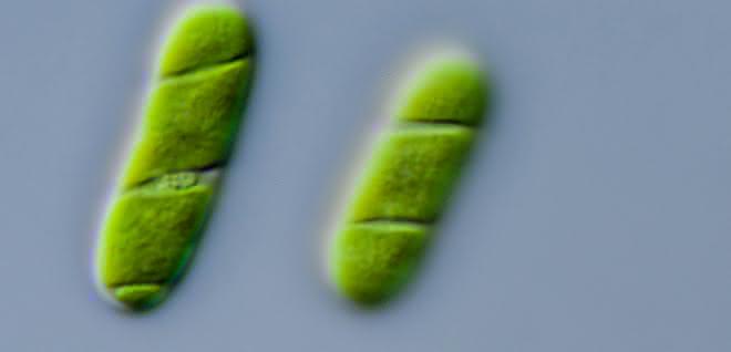 Mikroskopische Aufnahme von Algen