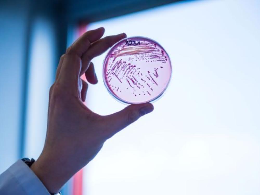 Selektivagarplatte, auf der ein multiresistenter Escherichia coli-Stamm wächst.